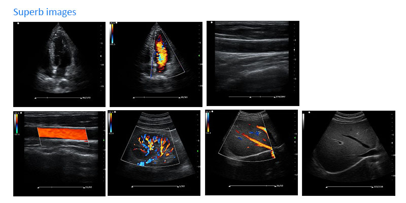 Superb ultrasound images by ES211V digital veterinary color Doppler ultrasound machine